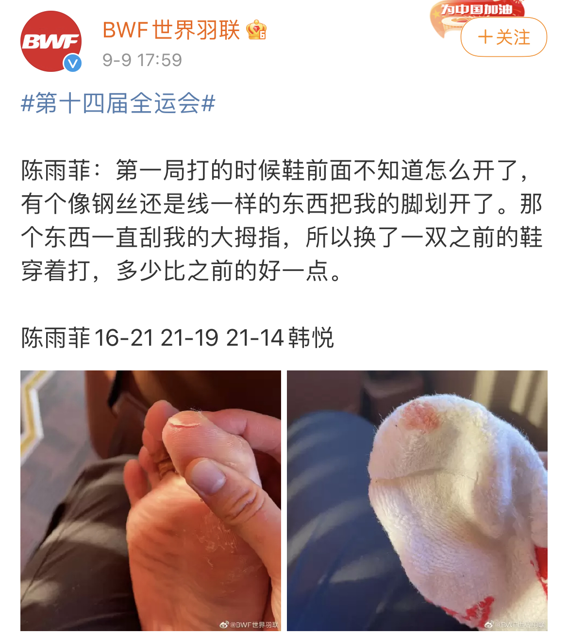 BWF posted Chen Yufei's right toe injury on its Chinese social media page. (photo: Sina)